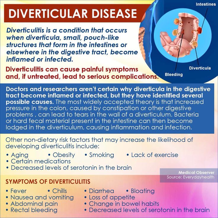 Diverticulitis Natural Treatment Thyroid Diverticulitis Natural Treatment Thyroid