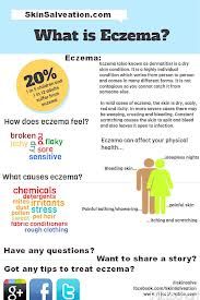 Natural Cures For Dyshidrotic Dermatitis Natural Cures For Dyshidrotic Dermatitis