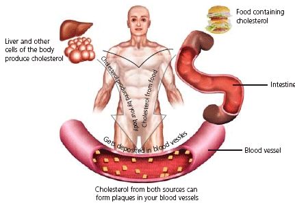 High Cholesterol Cures Natural Way High Cholesterol Cures Natural Way