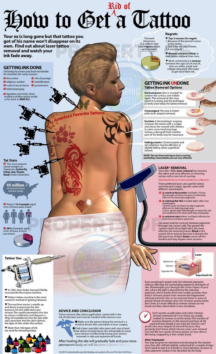 28 best laser tattoo removal images on pinterest acupressure 28 best laser tattoo removal images on pinterest acupressure