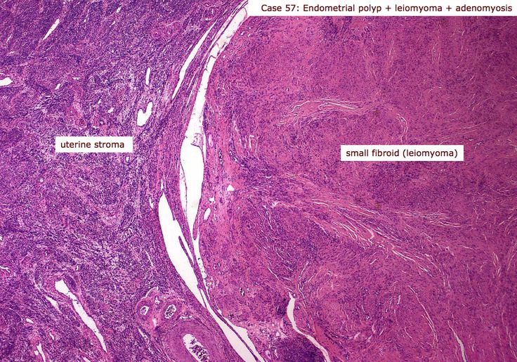 Best Natural Cures Lung Tumors Best Natural Cures Lung Tumors
