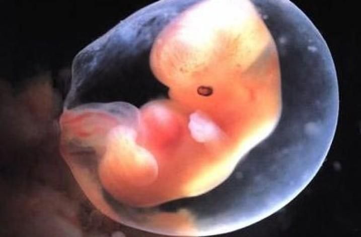 Pin on Real image's of life inside the womb