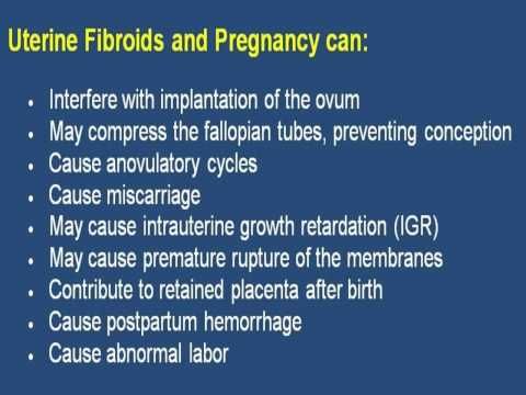 Tell City Indiana >> Large Uterine Fibroids And Pregnancy - SEE THIS VIDEO | FiBrOiDs | Pinterest | Uterine fibroids Tell City Indiana >> Large Uterine Fibroids And Pregnancy - SEE THIS VIDEO | FiBrOiDs | Pinterest | Uterine fibroids