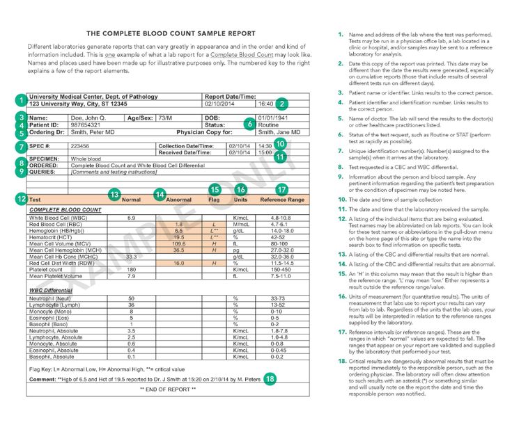 Buy lab reports online