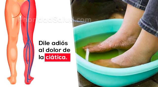 que pomada es buena para la ciatica
