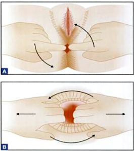 Ass fuck cafe Side affects of anal dilation