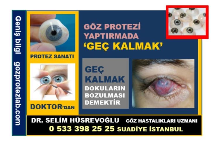 Selim Husrevoglu Adli Kullanicinin Goz Protezi Panosundaki Pin 2021 Doktorlar Bilgi Instagram Selim Husrevoglu Adli Kullanicinin Goz Protezi Panosundaki Pin 2021 Doktorlar Bilgi Instagram