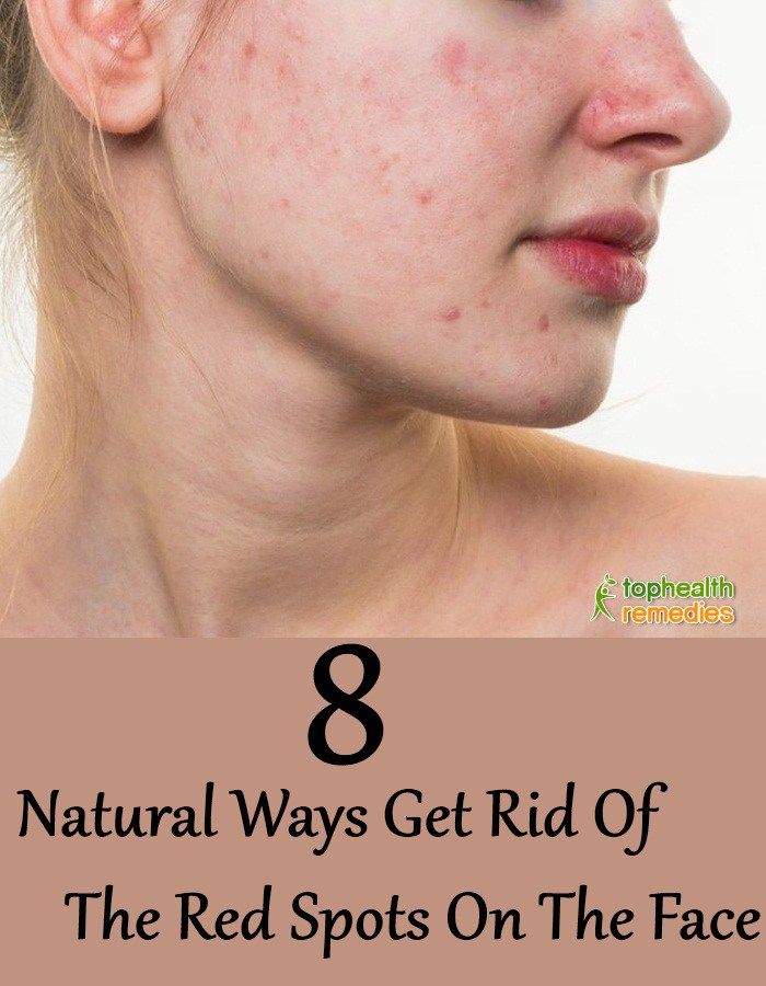 Facial red marks Mature femdom ass