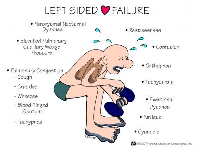 right-sided heart failure essay Congestive heart failure, also called chf or heart failure, is a serious and complex disease in which the heart muscle has been damaged or has to work too hard. right-sided heart failure essay Congestive heart failure, also called chf or heart failure, is a serious and complex disease in which the heart muscle has been damaged or has to work too hard.