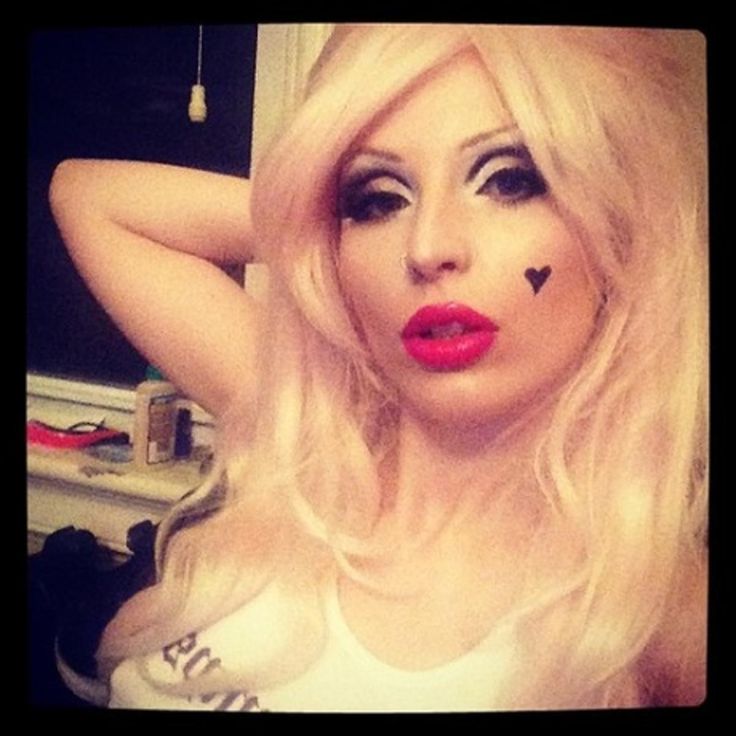 8 Things You Need to Know Before Getting Lip Injections