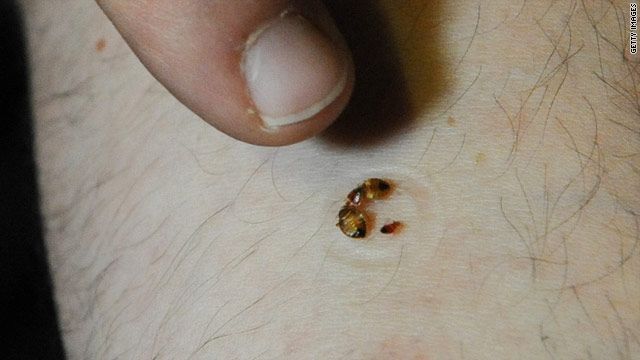 Bed Bugs Signs Of An Infestation & How To Get Rid Of Bed Bugs Alluring Small Insects In Bathroom Design Decoration Bed Bugs Signs Of An Infestation & How To Get Rid Of Bed Bugs Custom Small Insects In Bathroom Design Ideas