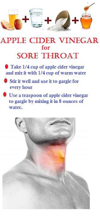 Best Natural Remedy For Extreme Sore Throat Best Natural Remedy For Extreme Sore Throat