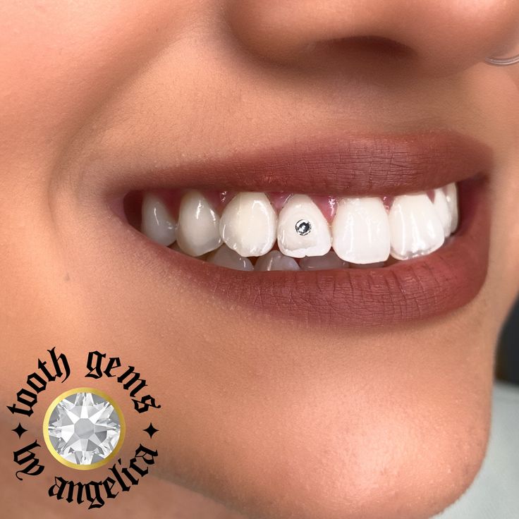 do tooth gems damage your teeth do tooth gems damage your teeth