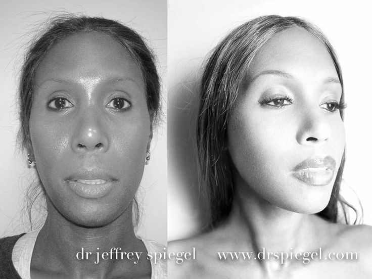 boston facial plastic surgeon girl looking to lose virginity