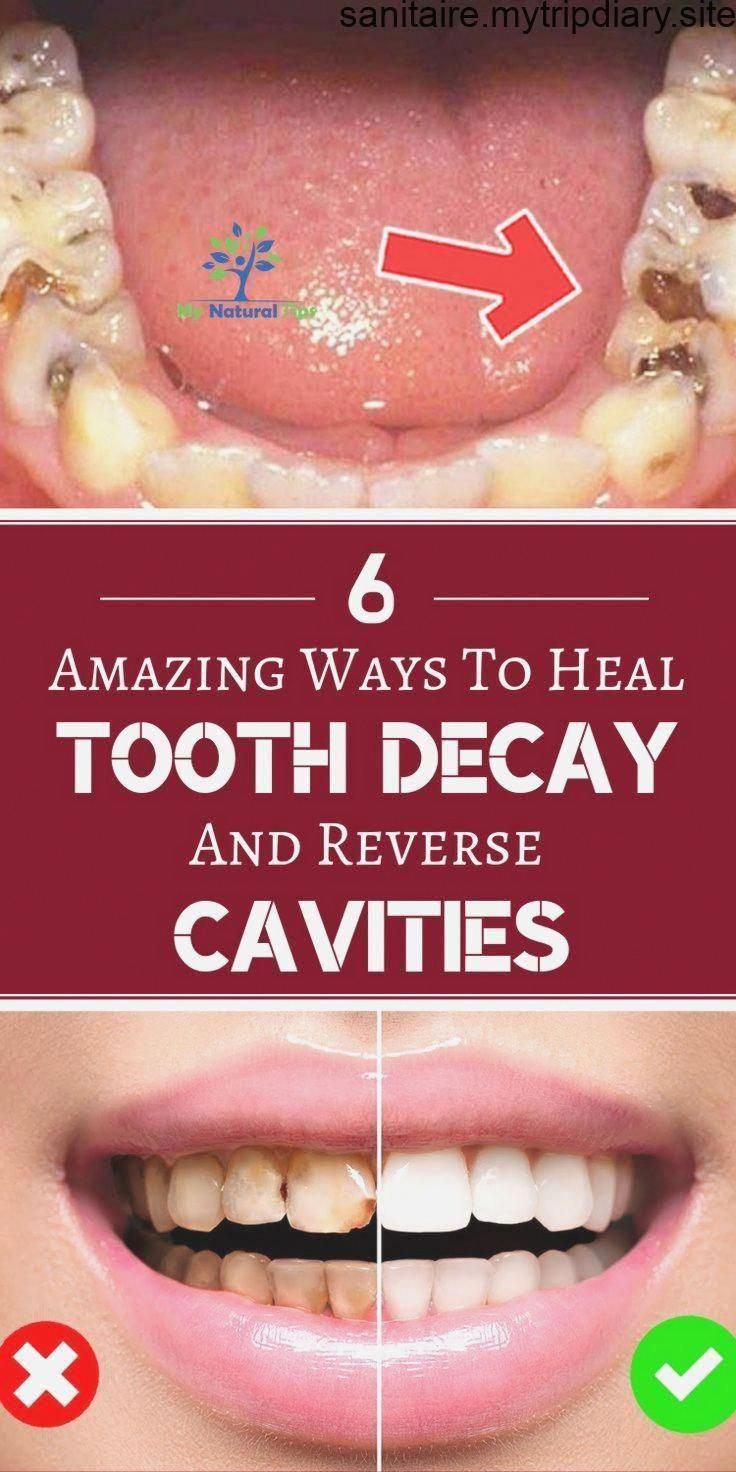 Pin on What Is The Best Oral Care Routine