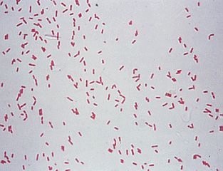 pseudomonas aeruginosa