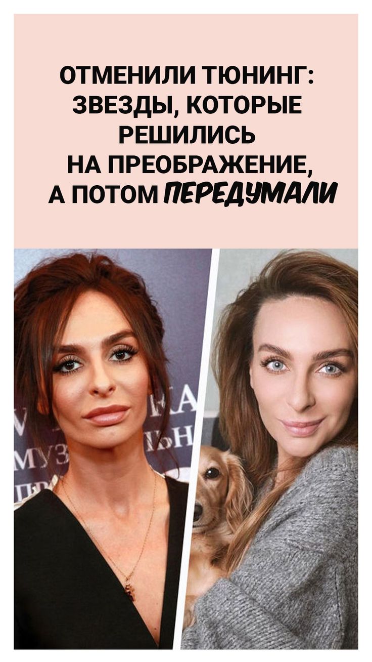 Певица Алекса До И После Пластики Фото Певица Алекса До И После Пластики Фото