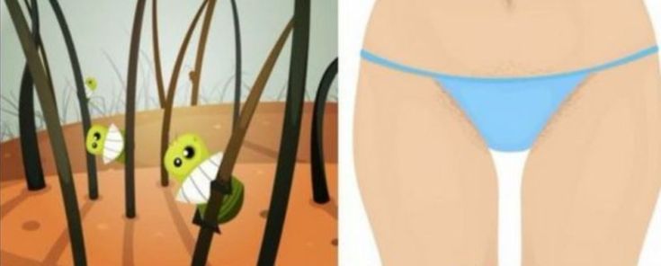 Remove the pubic hair permanently