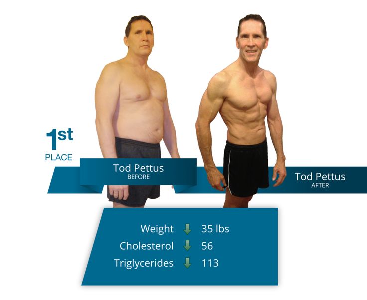 New fda approved weight loss procedures picture 2