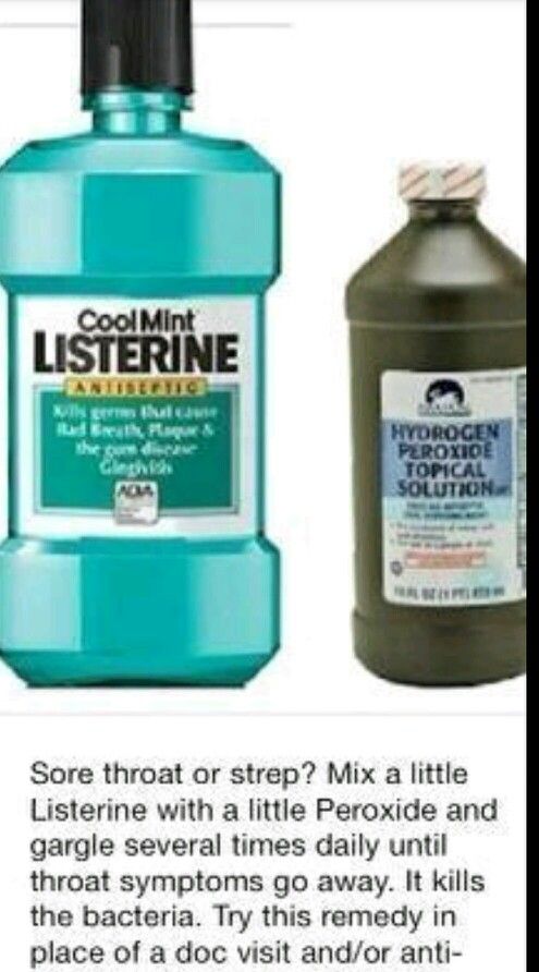 Peroxide strep throat