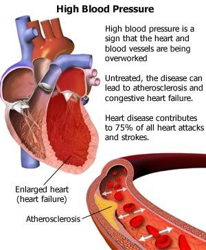 Can you take viagra with high blood pressure