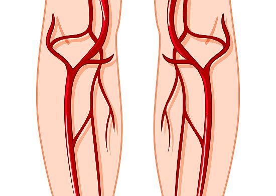 venele varicoase reticulare i hormoni frunzele de struguri cu varicoza