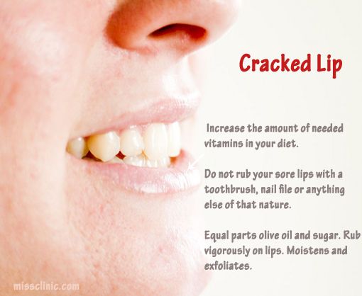 Natural Remedies For Deep Chest Cough Natural Remedies For Deep Chest Cough
