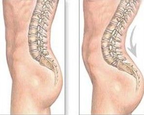 15 ways to lose weight picture 5