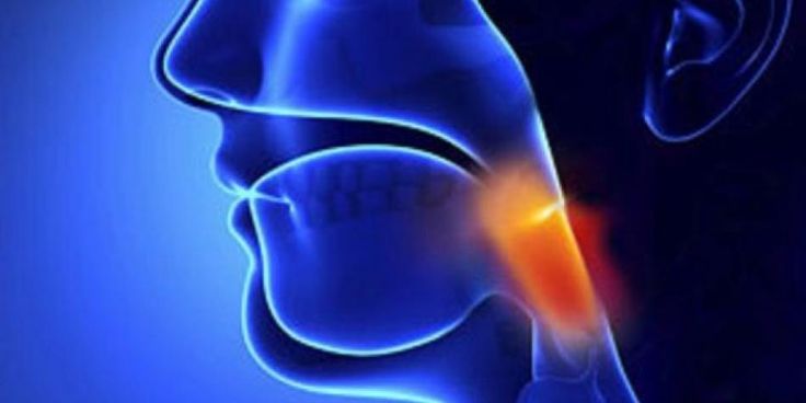 cancer de colon quimioterapia
