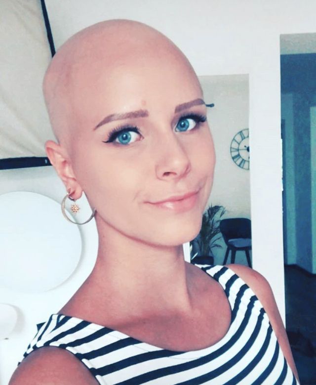 Pin On Bald Women 11