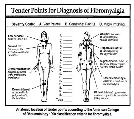 Fibromyalgia Trigger Points Chart Pdf Tender Fibromyalgia Point Chart Tender Points For Diagnosis Of