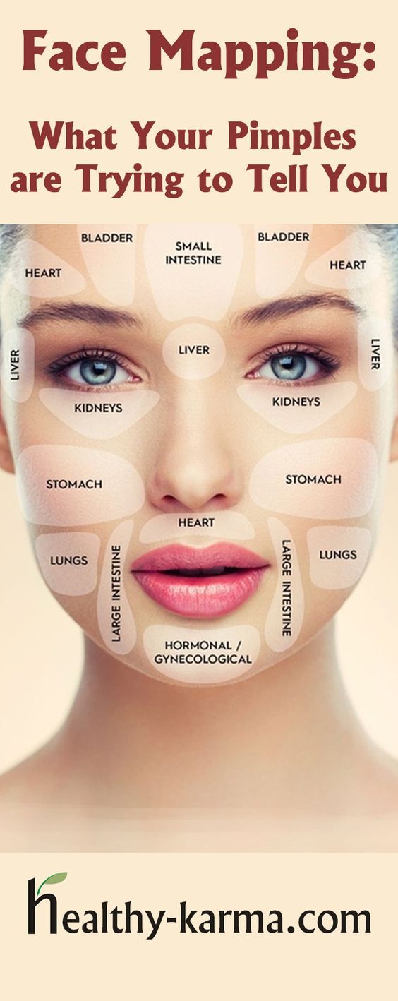 best 25 face mapping ideas on pinterest skin mapping acne causes chart