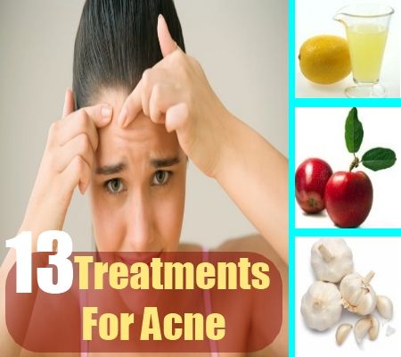 Best Natural Remedies For Goiter Best Natural Remedies For Goiter