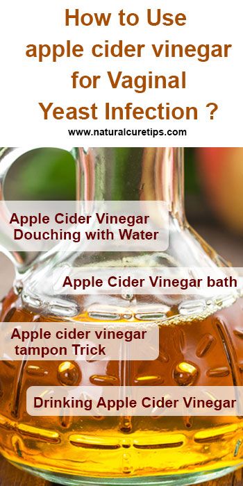 How to Use apple cider vinegar for Vaginal Yeast Infection