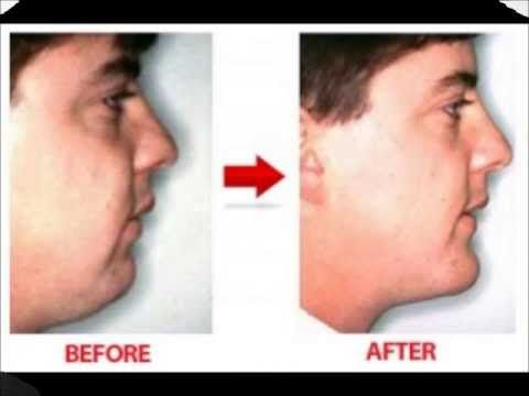 cinnamon and honey weight loss dr. oz cinnamon and honey weight loss dr. oz