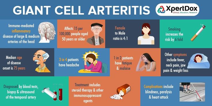 Giant cell arteritis (GCA) is a group of disorders that cause inflammation of bl...