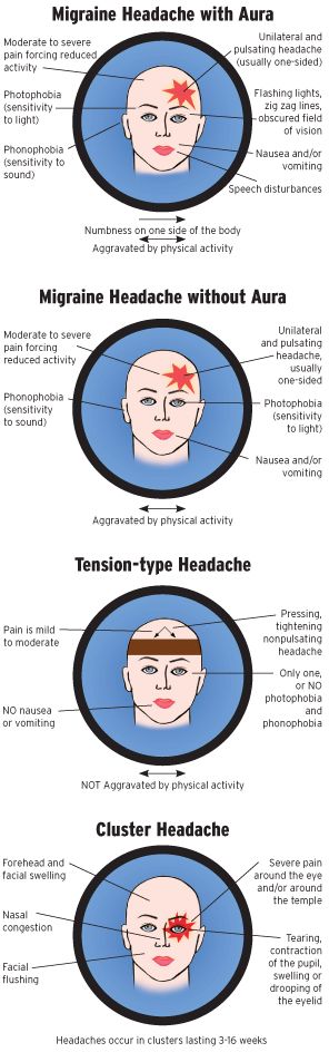 types of headaches chart chart paketsusudomba co types of headache chart