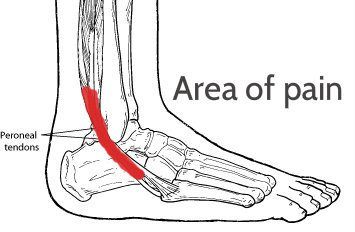 Best Running Shoes For Achilles Tendon Issues Best Running Shoes For Achilles Tendon Issues