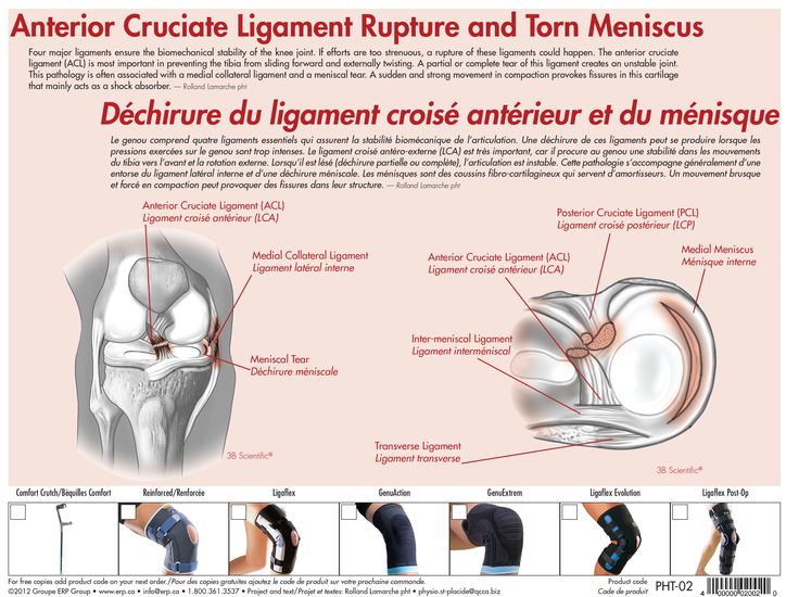 the anterior cruciate ligament acl injuries In this video, our lead litigator and partner tim williams discusses one of the areas most commonly injured in serious accidents involving the knee: the anterior cruciate ligament (acl. the anterior cruciate ligament acl injuries In this video, our lead litigator and partner tim williams discusses one of the areas most commonly injured in serious accidents involving the knee: the anterior cruciate ligament (acl.