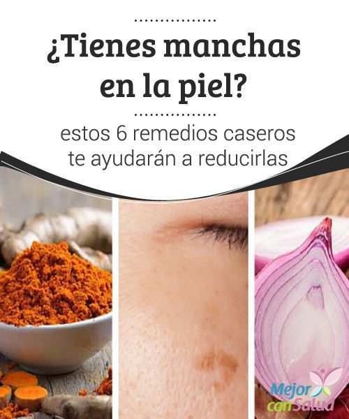 270 best Remedios Caseros images on Pinterest | Healthy 270 best Remedios Caseros images on Pinterest | Healthy