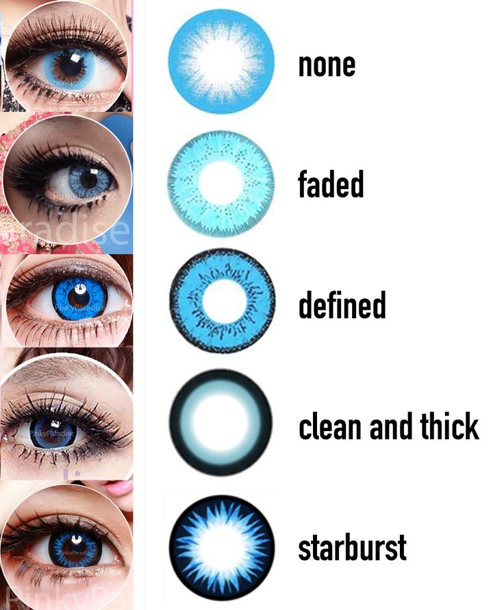 Teal Ring Around My Iris Teal Ring Around My Iris