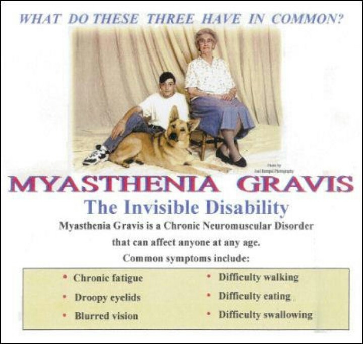 How To Treat Myasthenia Gravis Naturally How To Treat Myasthenia Gravis Naturally