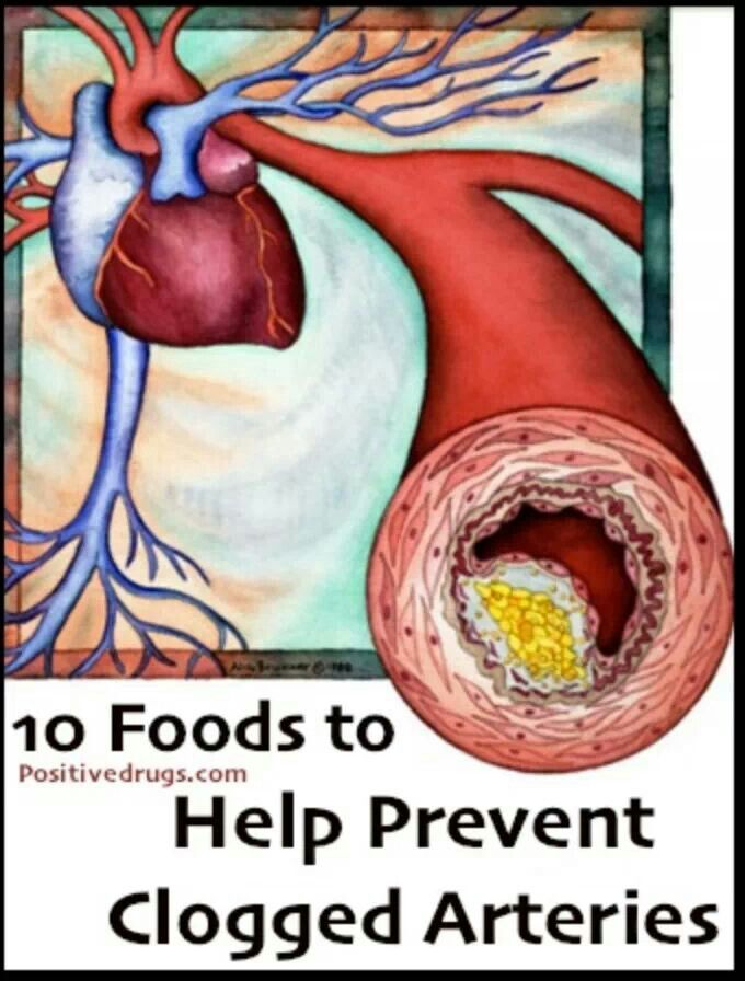 Natural Remedies To Clean Out Your Arteries Natural Remedies To Clean Out Your Arteries