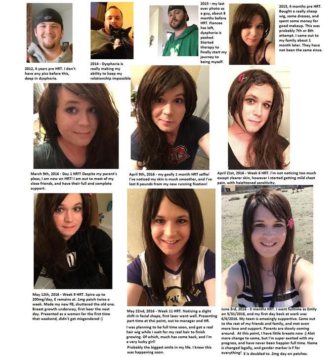 Facial changes mtf estrogen