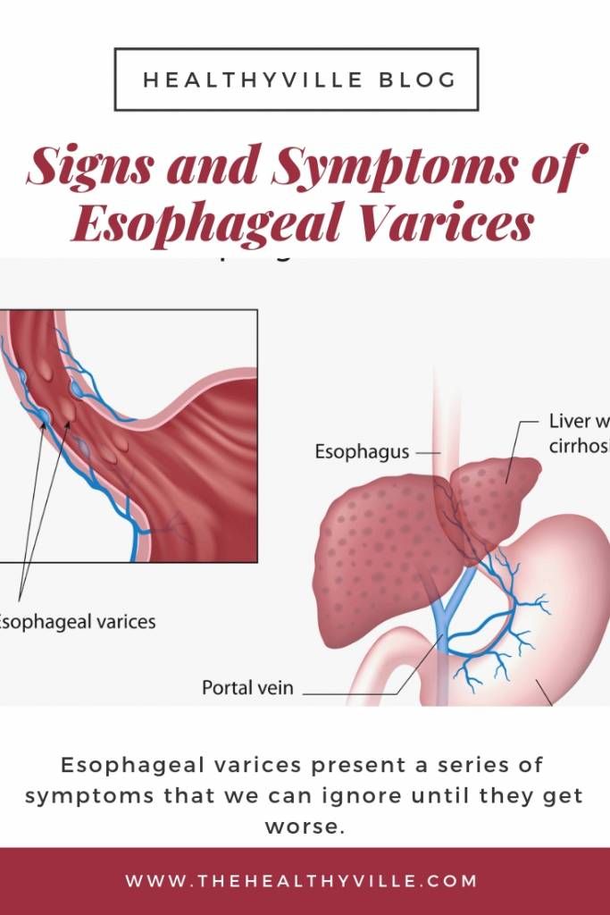 Varicele - Cauze, Simptome, Tratament | Ayurmed