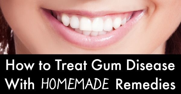 How To Treat Swollen Gums Naturally How To Treat Swollen Gums Naturally
