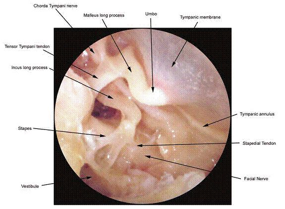 mobiltelefoner best i test piercing i klitten mobiltelefoner best i test piercing i klitten