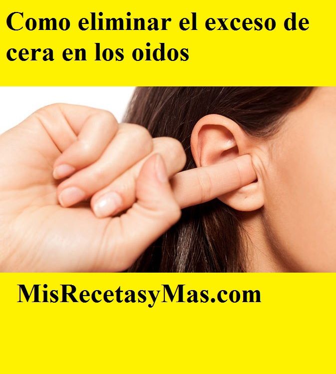 Eliminar El Exceso De Cera En Los Oidos Cera Oídos Excesodecera Remedios Remedioscaseros Remediosnaturales Salud Tips Enfermedades