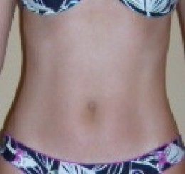 Can hypertension medication cause weight loss picture 2