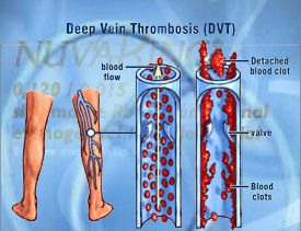 30 10 weight loss for life locations of chase 30 10 weight loss for life locations of chase